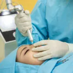 Phẫu thuật nâng mũi 6 6