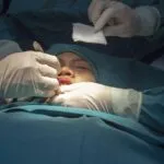 Phẫu thuật độn cằm 6 a5 1 1