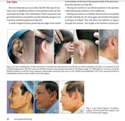 Thành tựu của Bác Sĩ Nguyên Giáp 3 d3c3af0133f4e7aabee5 1 415x400 1