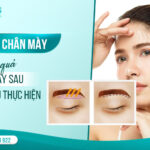 Treo chân mày hiệu quả ngay sau lần đầu thực hiện